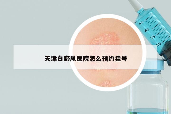 天津白癜风医院怎么预约挂号
