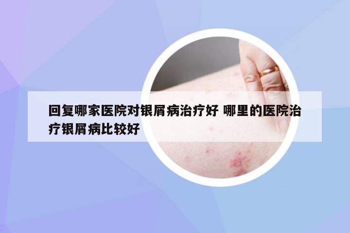 回复哪家医院对银屑病治疗好 哪里的医院治疗银屑病比较好