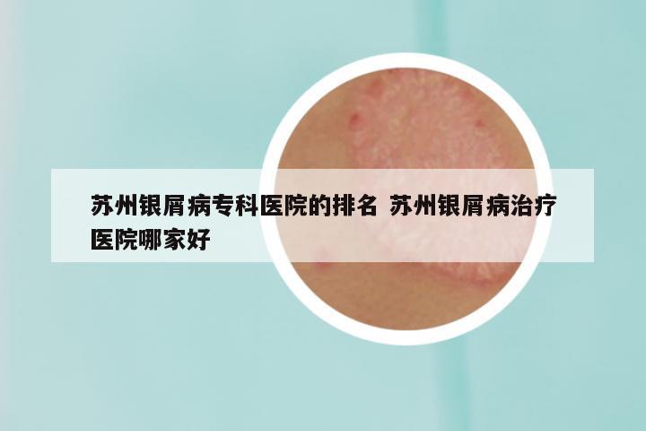 苏州银屑病专科医院的排名 苏州银屑病治疗医院哪家好