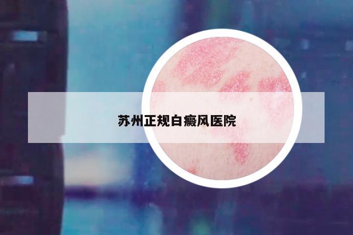 苏州正规白癜风医院
