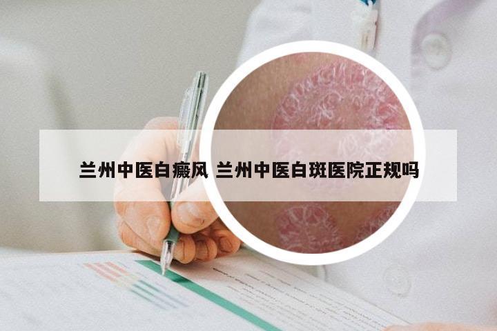 兰州中医白癜风 兰州中医白斑医院正规吗