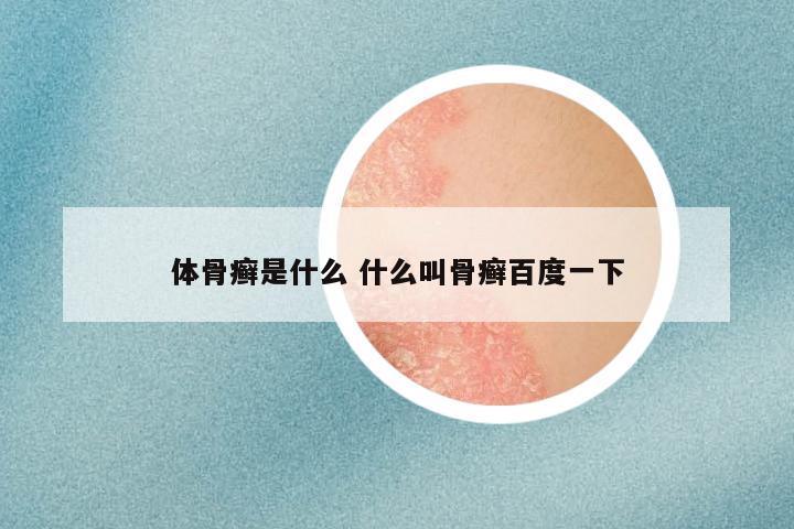 体骨癣是什么 什么叫骨癣百度一下