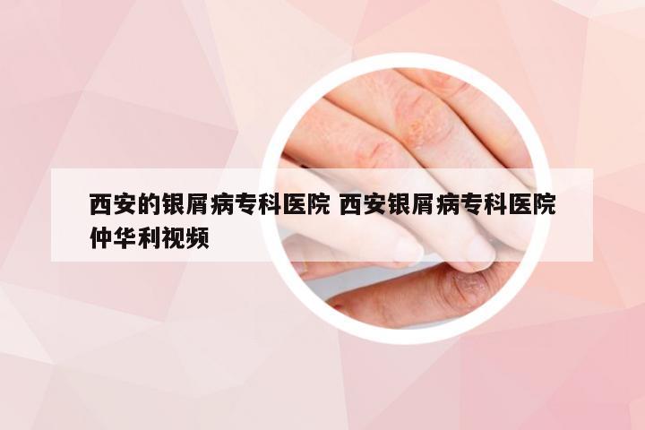 西安的银屑病专科医院 西安银屑病专科医院仲华利视频