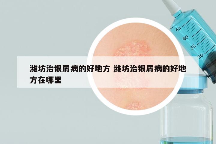潍坊治银屑病的好地方 潍坊治银屑病的好地方在哪里