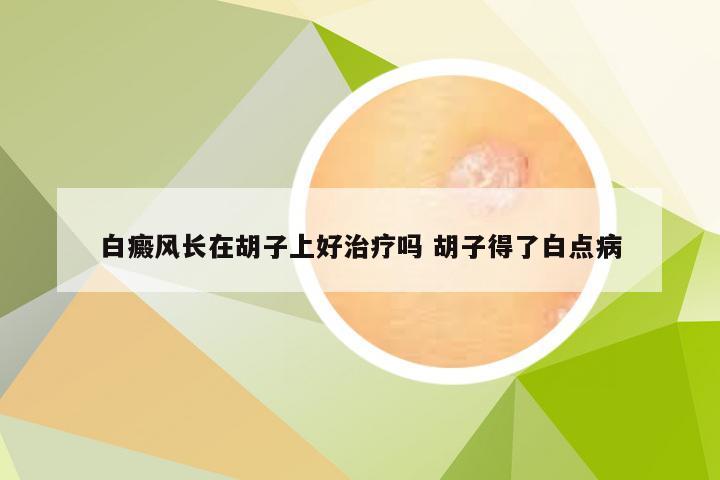白癜风长在胡子上好治疗吗 胡子得了白点病