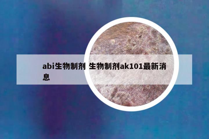 abi生物制剂 生物制剂ak101最新消息