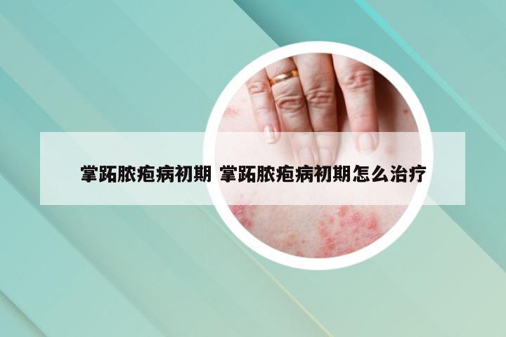 掌跖脓疱病初期 掌跖脓疱病初期怎么治疗