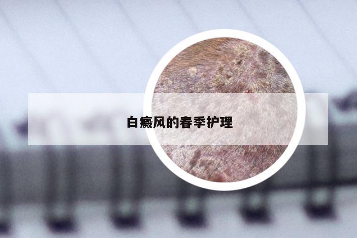 白癜风的春季护理