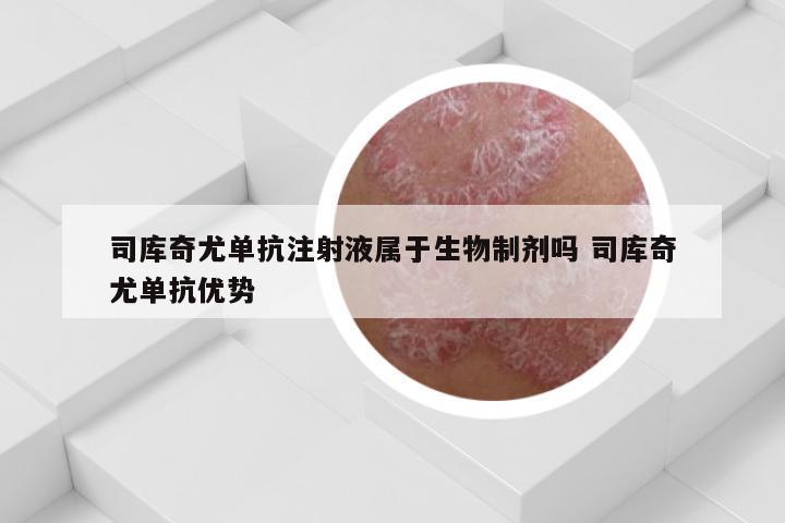 司库奇尤单抗注射液属于生物制剂吗 司库奇尤单抗优势