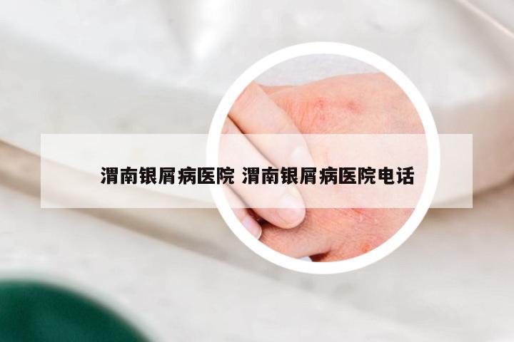 渭南银屑病医院 渭南银屑病医院电话