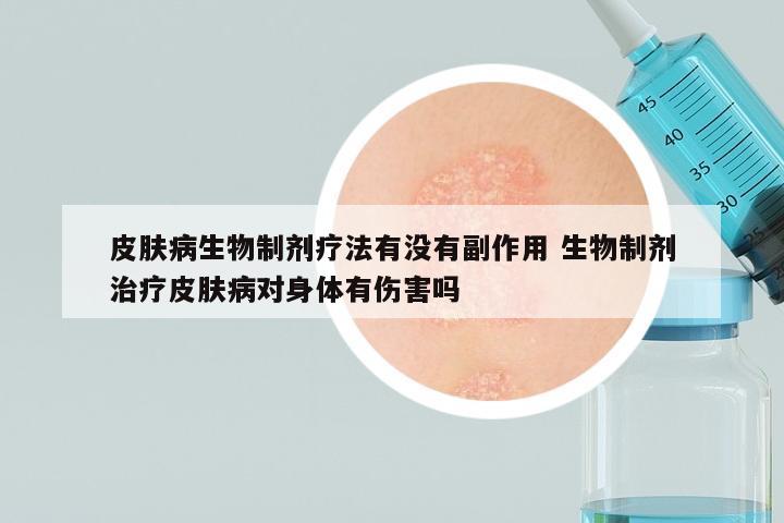 皮肤病生物制剂疗法有没有副作用 生物制剂治疗皮肤病对身体有伤害吗