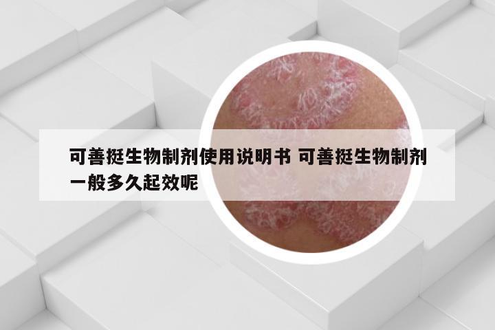 可善挺生物制剂使用说明书 可善挺生物制剂一般多久起效呢