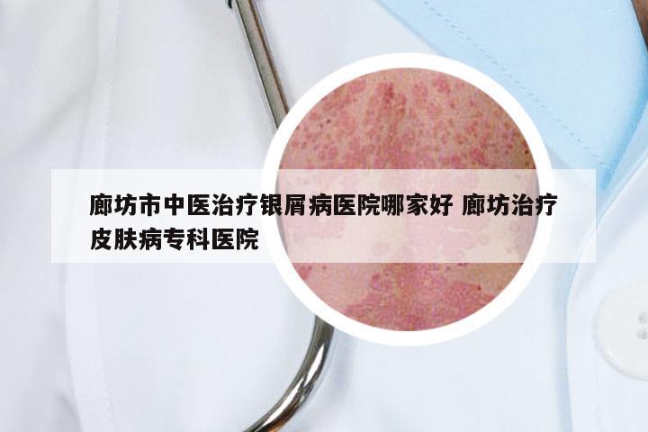 廊坊市中医治疗银屑病医院哪家好 廊坊治疗皮肤病专科医院
