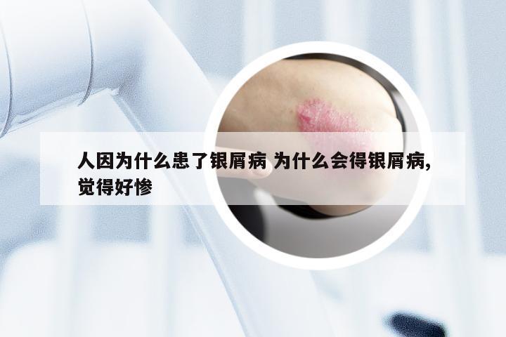人因为什么患了银屑病 为什么会得银屑病,觉得好惨