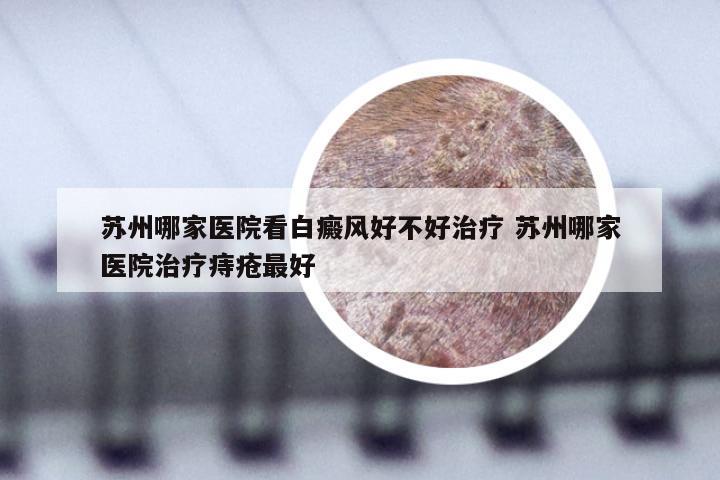 苏州哪家医院看白癜风好不好治疗 苏州哪家医院治疗痔疮最好