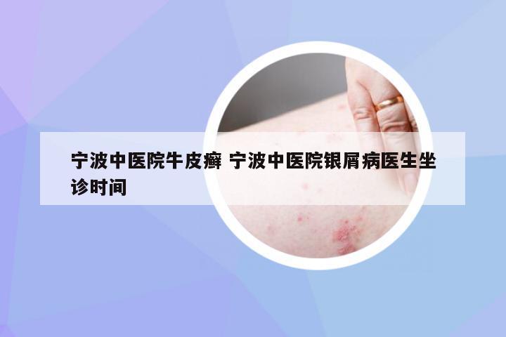 宁波中医院牛皮癣 宁波中医院银屑病医生坐诊时间
