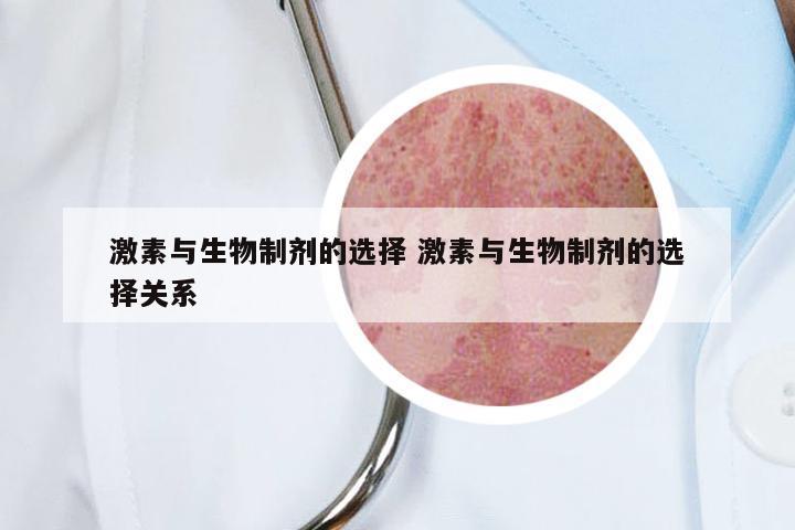 激素与生物制剂的选择 激素与生物制剂的选择关系