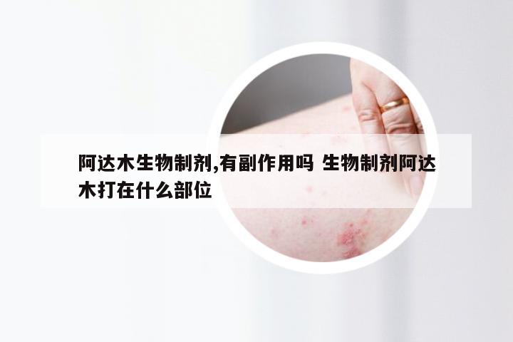 阿达木生物制剂,有副作用吗 生物制剂阿达木打在什么部位