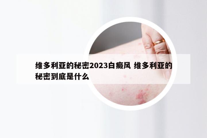 维多利亚的秘密2023白癜风 维多利亚的秘密到底是什么