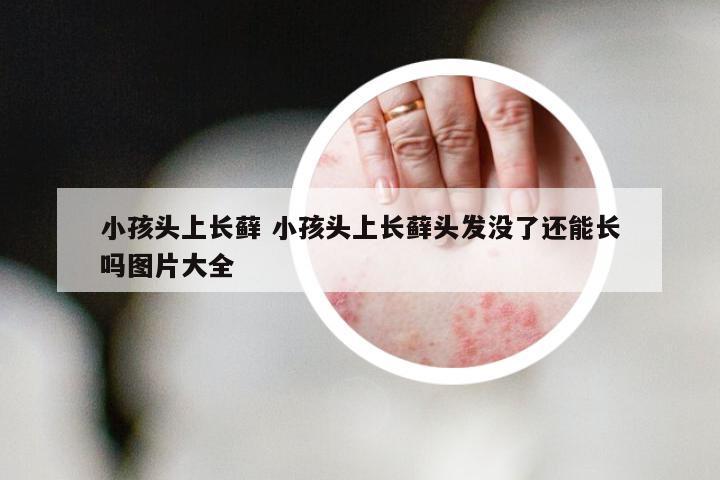 小孩头上长藓 小孩头上长藓头发没了还能长吗图片大全