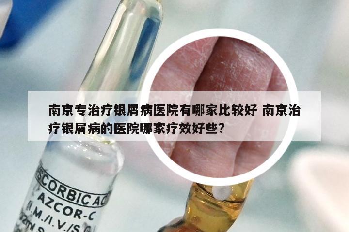 南京专治疗银屑病医院有哪家比较好 南京治疗银屑病的医院哪家疗效好些?
