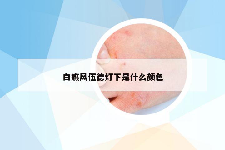 白癜风伍德灯下是什么颜色