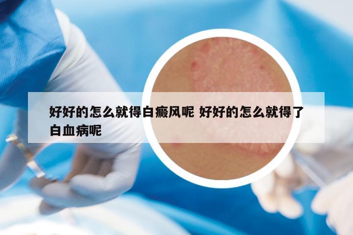 好好的怎么就得白癜风呢 好好的怎么就得了白血病呢