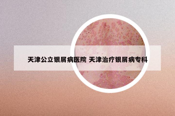 天津公立银屑病医院 天津治疗银屑病专科