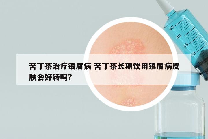 苦丁茶治疗银屑病 苦丁茶长期饮用银屑病皮肤会好转吗?