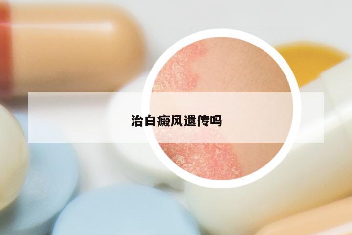 治白癜风遗传吗