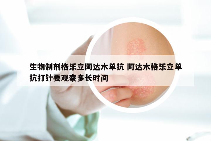 生物制剂格乐立阿达木单抗 阿达木格乐立单抗打针要观察多长时间