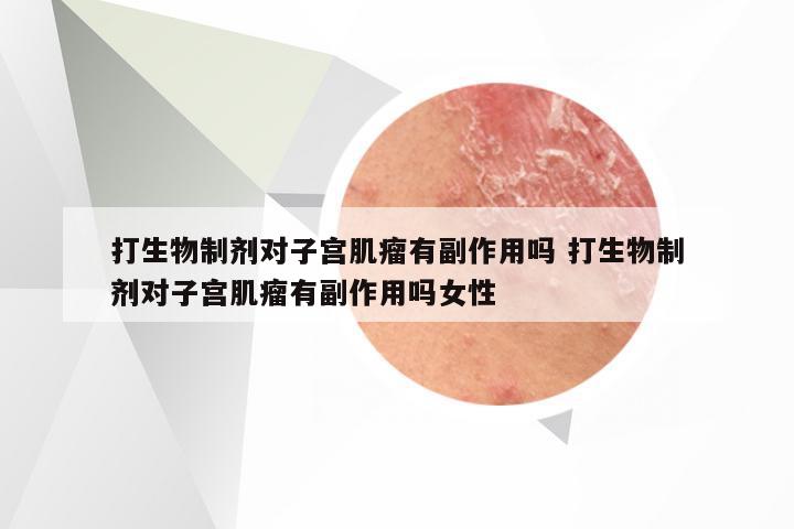 打生物制剂对子宫肌瘤有副作用吗 打生物制剂对子宫肌瘤有副作用吗女性
