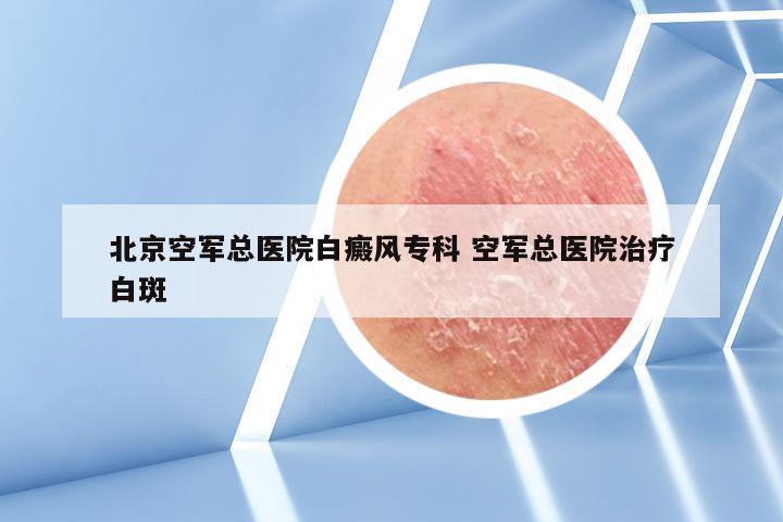 北京空军总医院白癜风专科 空军总医院治疗白斑
