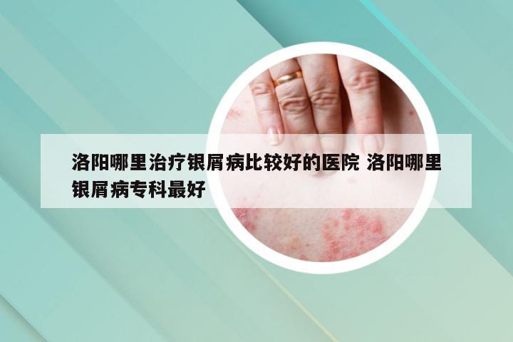 洛阳哪里治疗银屑病比较好的医院 洛阳哪里银屑病专科最好