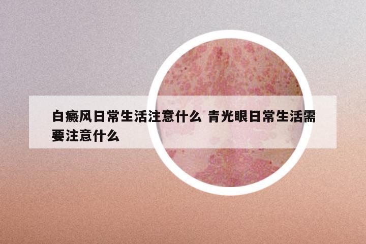 白癜风日常生活注意什么 青光眼日常生活需要注意什么
