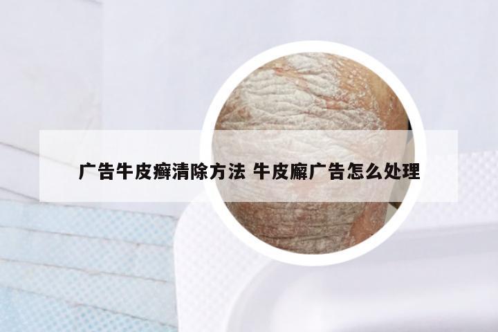 广告牛皮癣清除方法 牛皮廨广告怎么处理