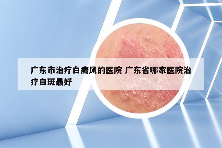 广东市治疗白癜风的医院 广东省哪家医院治疗白斑最好