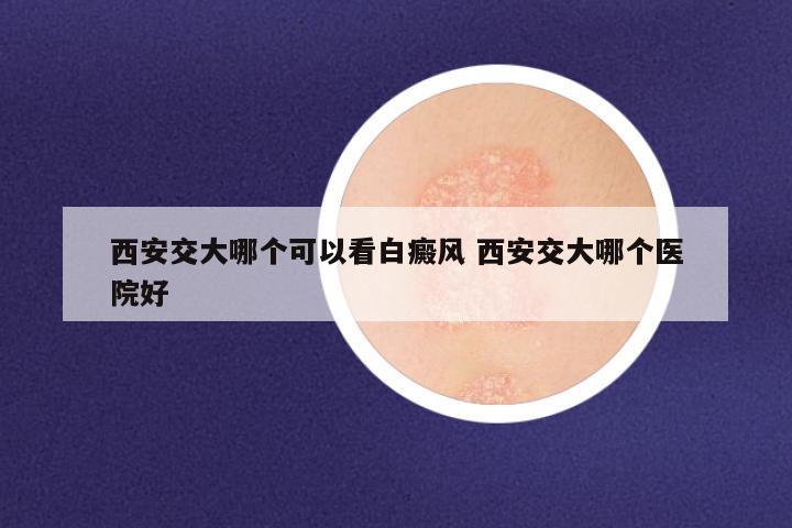 西安交大哪个可以看白癜风 西安交大哪个医院好