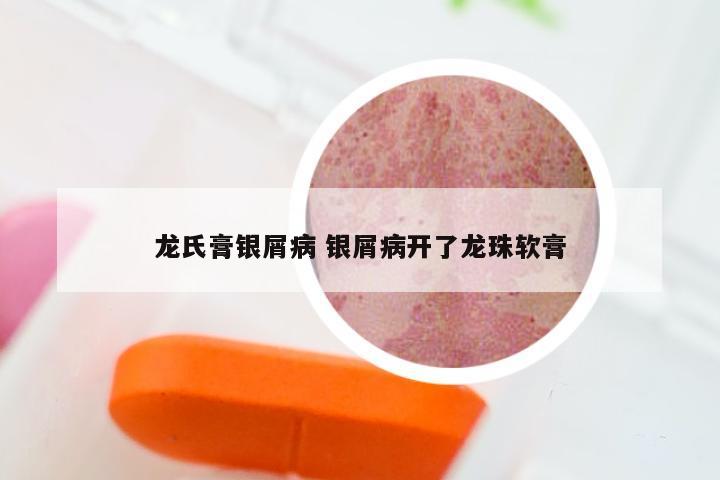 龙氏膏银屑病 银屑病开了龙珠软膏