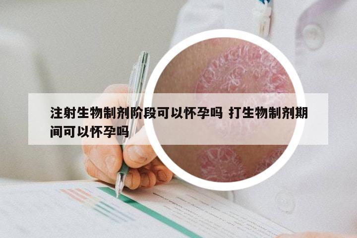 注射生物制剂阶段可以怀孕吗 打生物制剂期间可以怀孕吗
