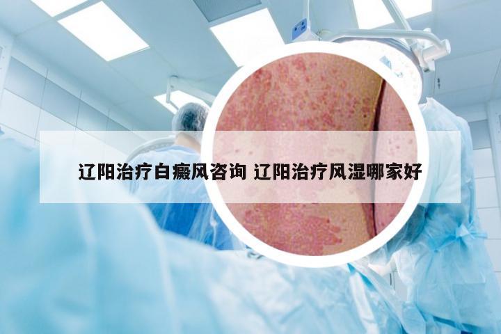 辽阳治疗白癜风咨询 辽阳治疗风湿哪家好