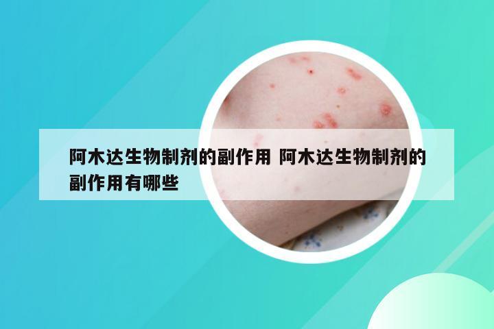 阿木达生物制剂的副作用 阿木达生物制剂的副作用有哪些