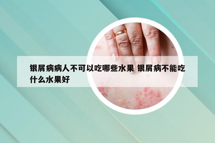 银屑病病人不可以吃哪些水果 银屑病不能吃什么水果好