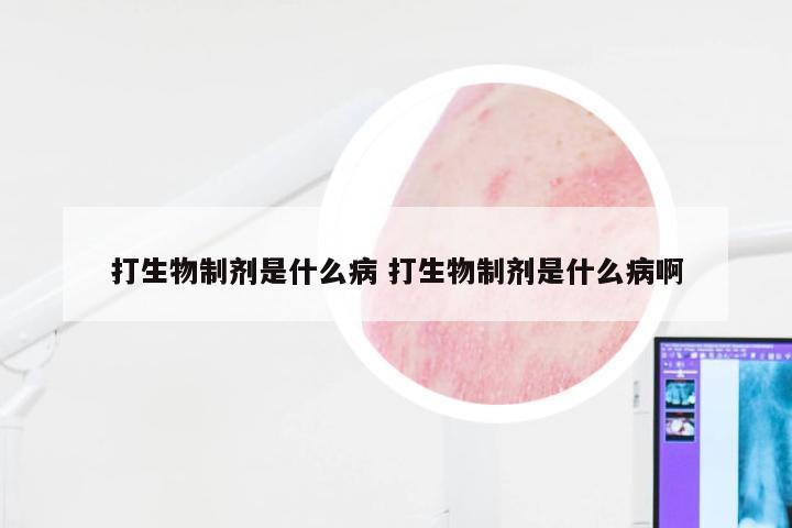 打生物制剂是什么病 打生物制剂是什么病啊