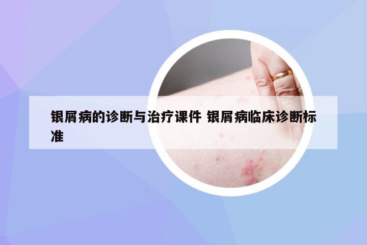 银屑病的诊断与治疗课件 银屑病临床诊断标准