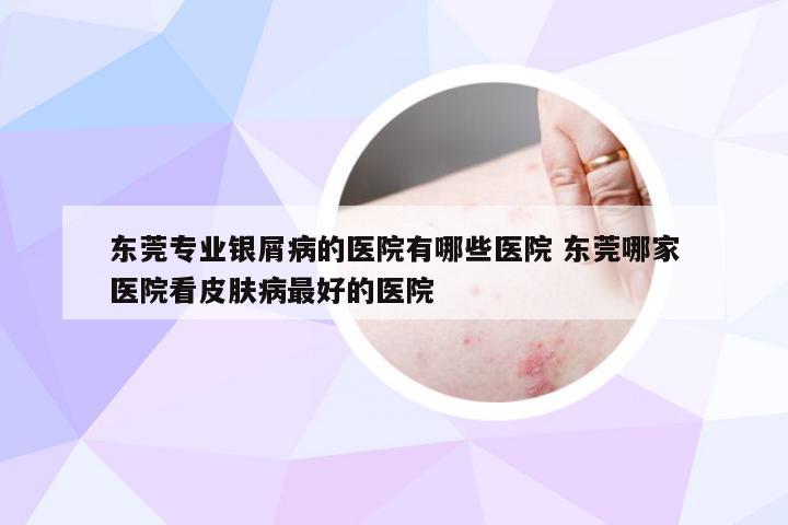 东莞专业银屑病的医院有哪些医院 东莞哪家医院看皮肤病最好的医院