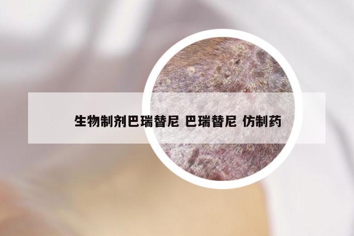 生物制剂巴瑞替尼 巴瑞替尼 仿制药