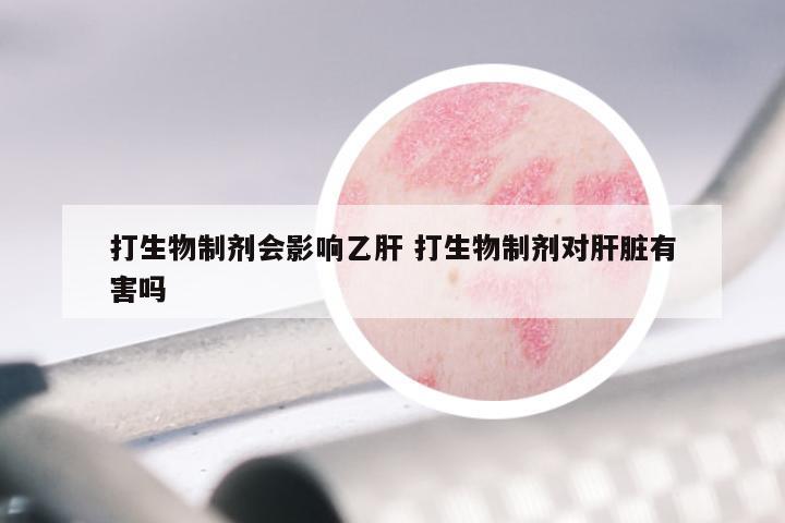打生物制剂会影响乙肝 打生物制剂对肝脏有害吗