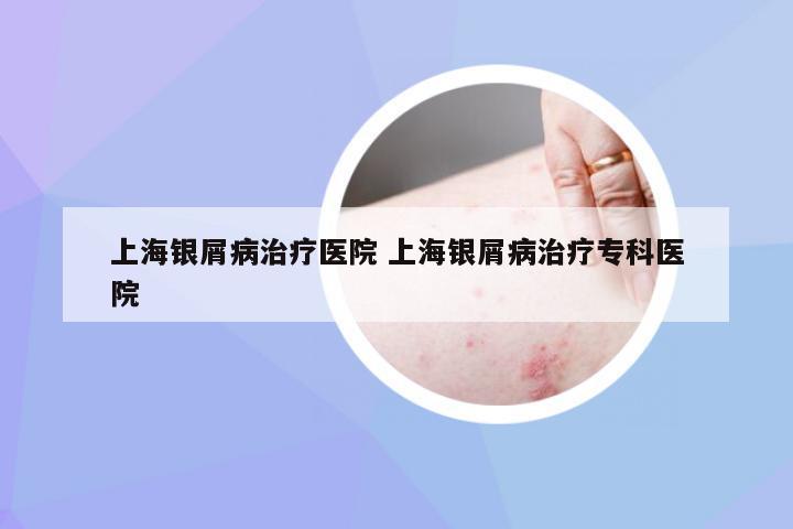 上海银屑病治疗医院 上海银屑病治疗专科医院
