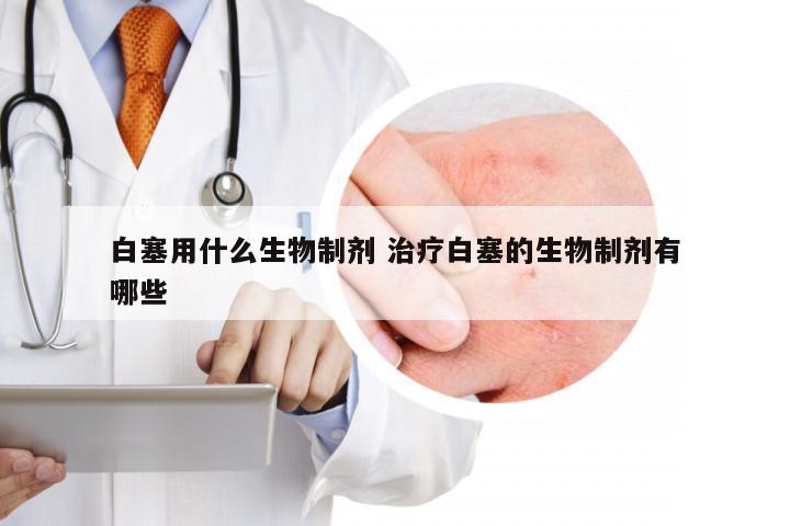 白塞用什么生物制剂 治疗白塞的生物制剂有哪些